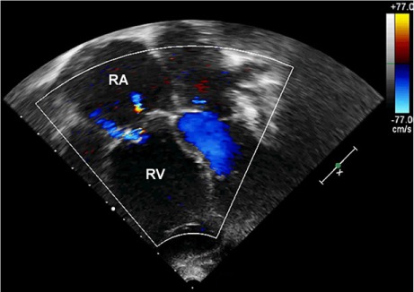 Fig. 4.