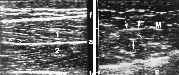 Fig. 7