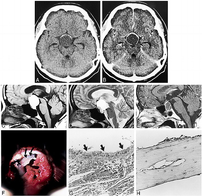 fig 1.