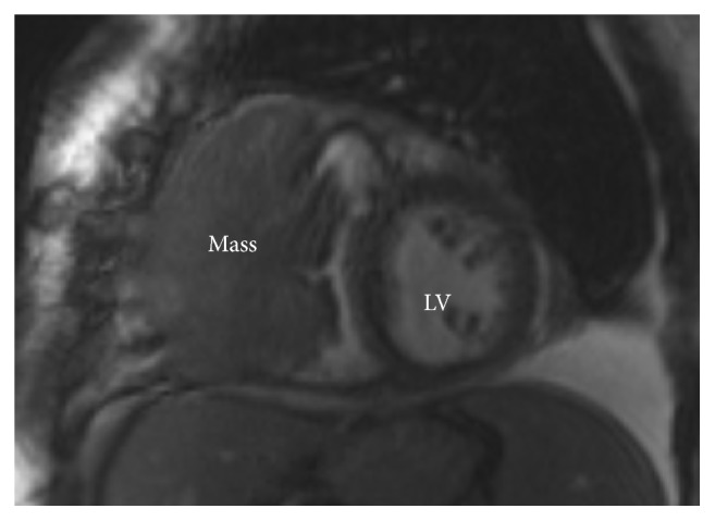 Figure 4