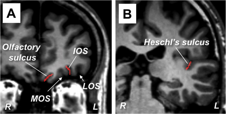 Fig. 1