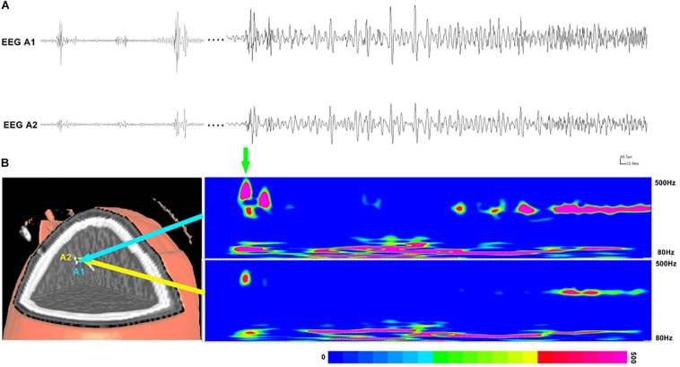 FIGURE 3