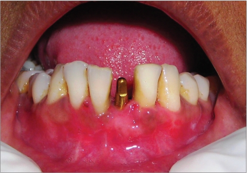 Figure 1c