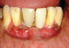Figure 3h