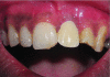 Figure 2i