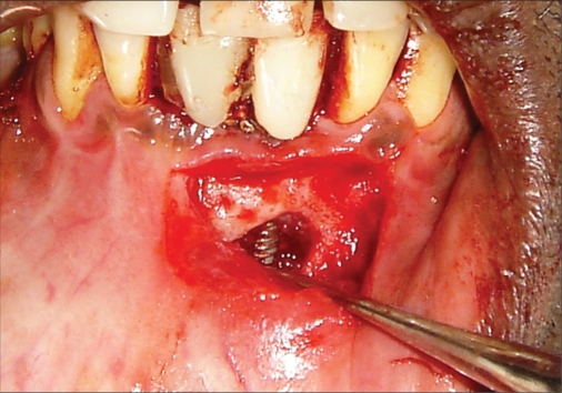 Figure 3e