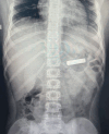 Fig. 1