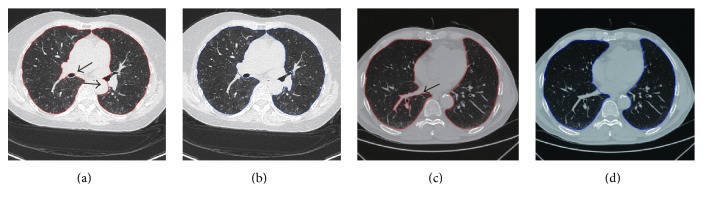 Figure 16