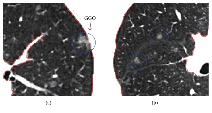 Figure 15