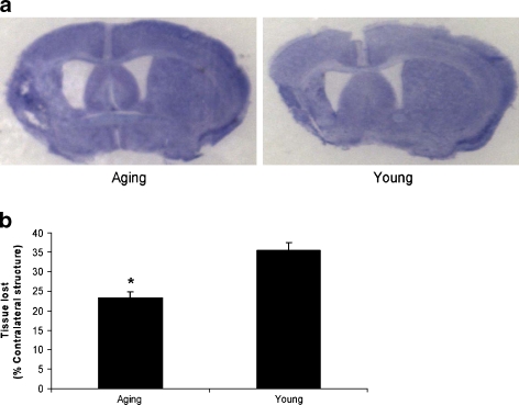 Fig. 1