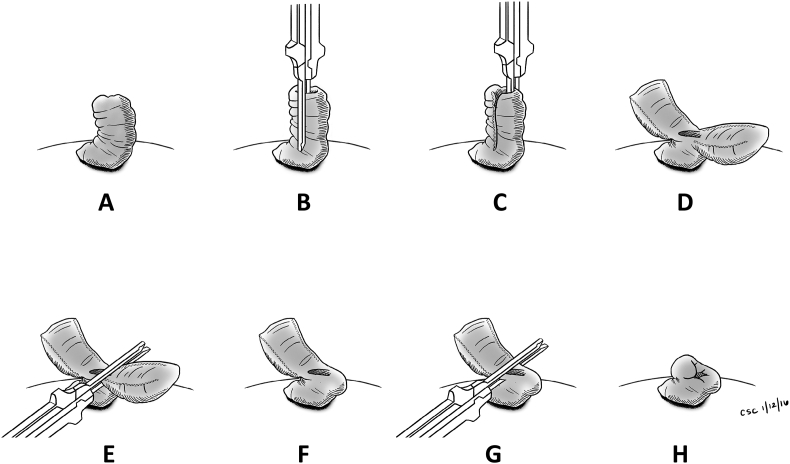 Fig. 2