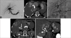 Figure 5: