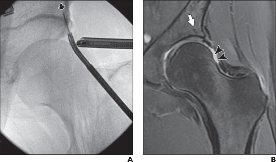 Fig. 3—