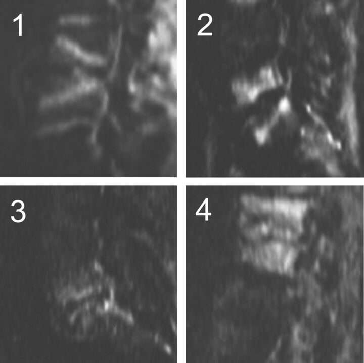 Fig 2.