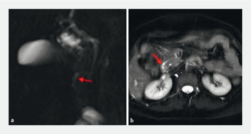 Fig. 1