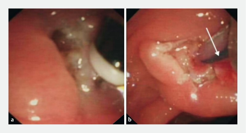 Fig. 3 a