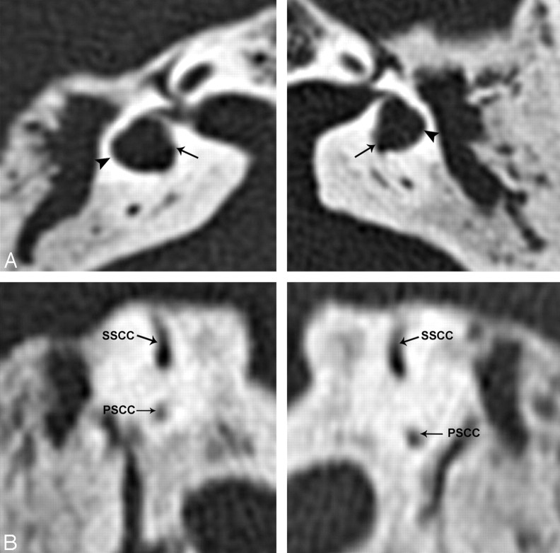 Fig 4.