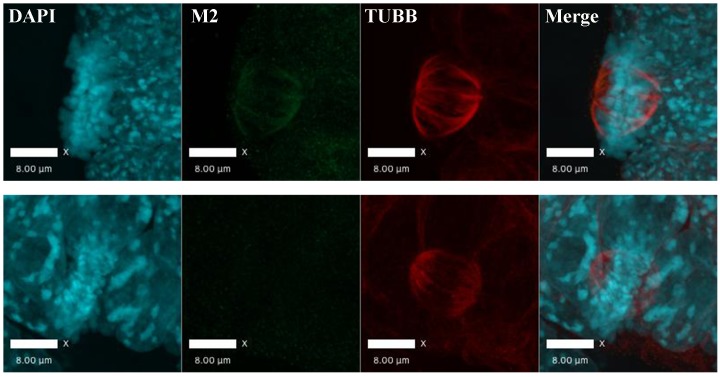 Figure 2—figure supplement 1.