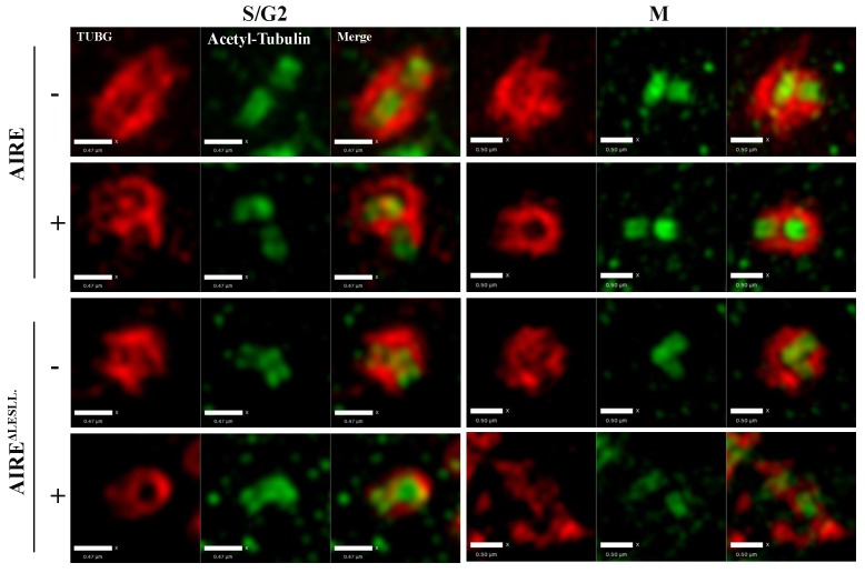 Figure 5—figure supplement 2.