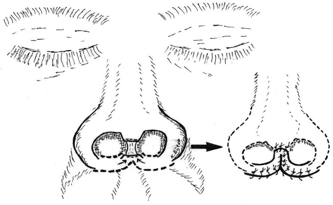 Figure 2