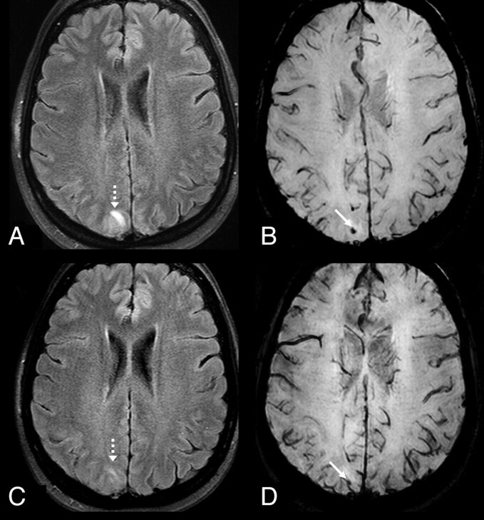 Fig 2.