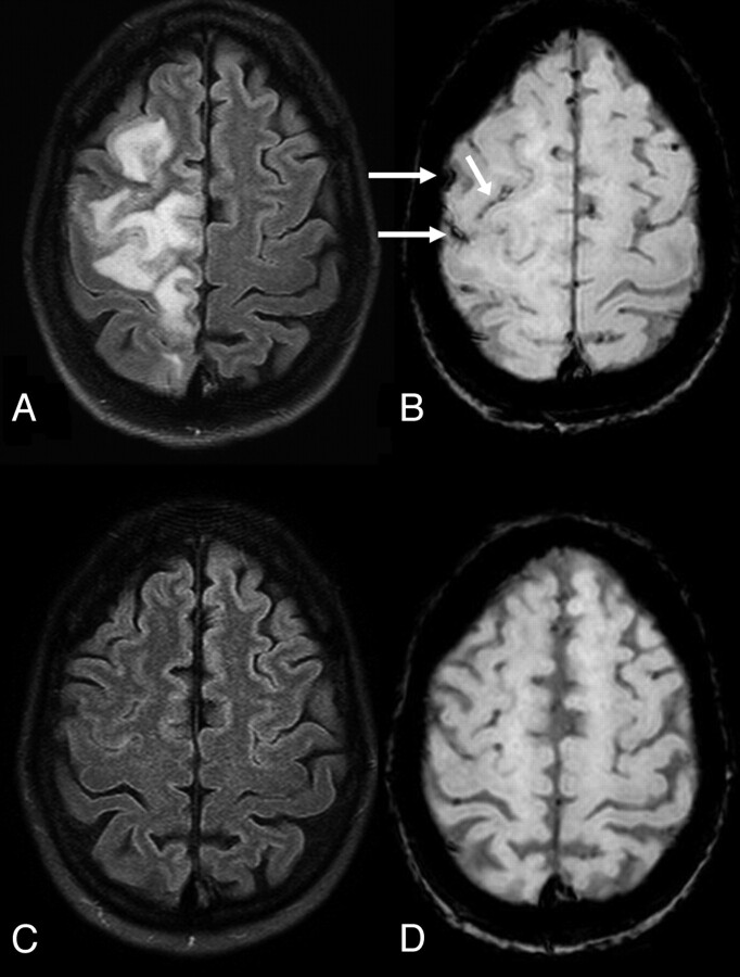 Fig 3.