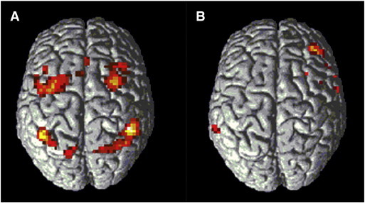 Fig. 3