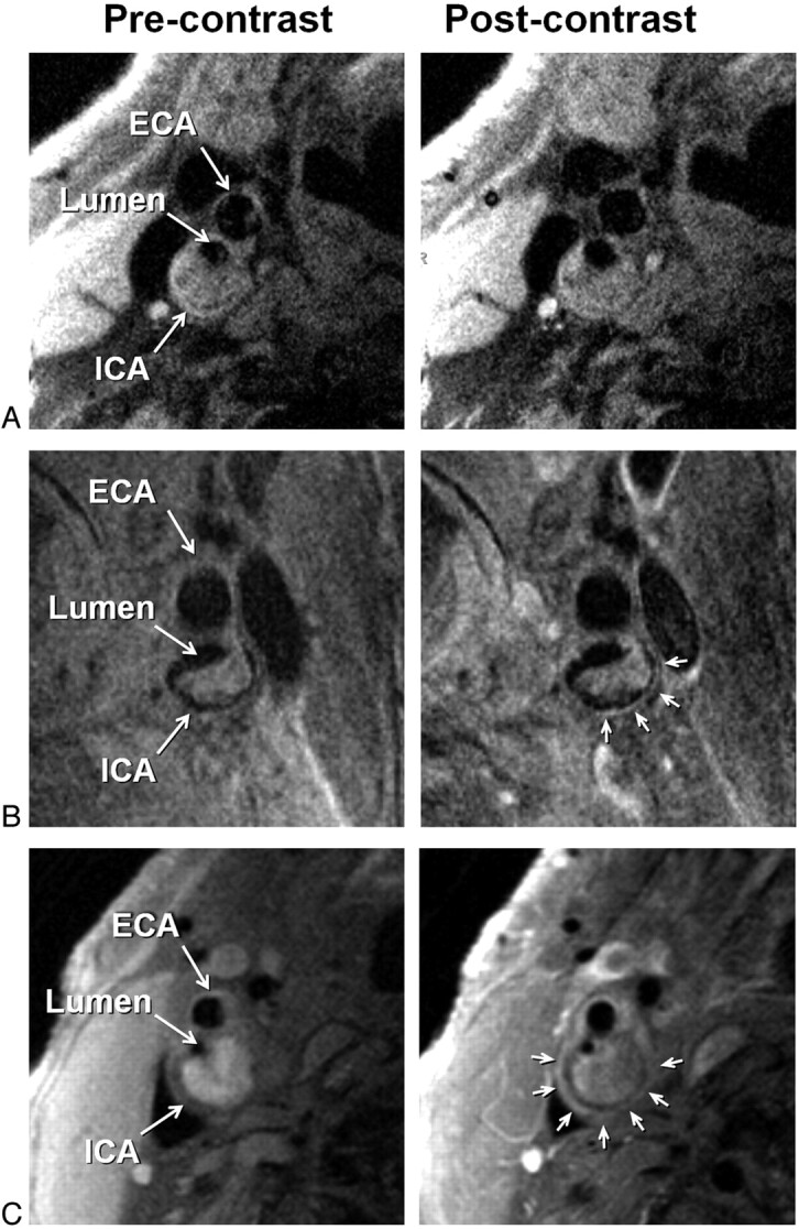 Fig 2.