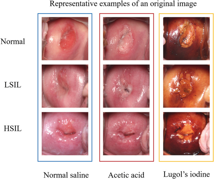 FIGURE 3