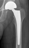 Fig. 2