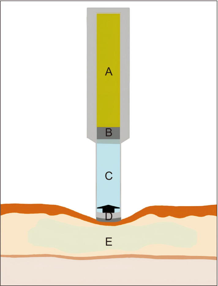 Fig. 2