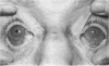 199