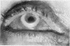 200