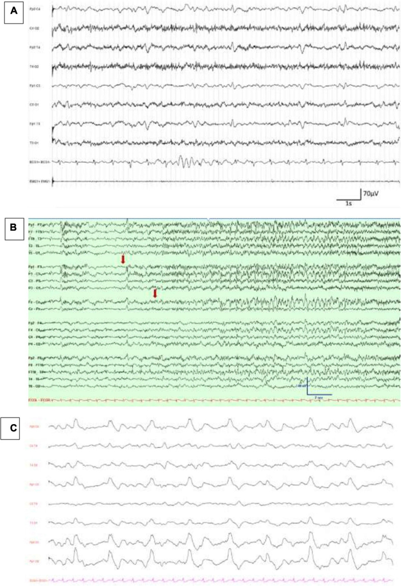 FIGURE 1