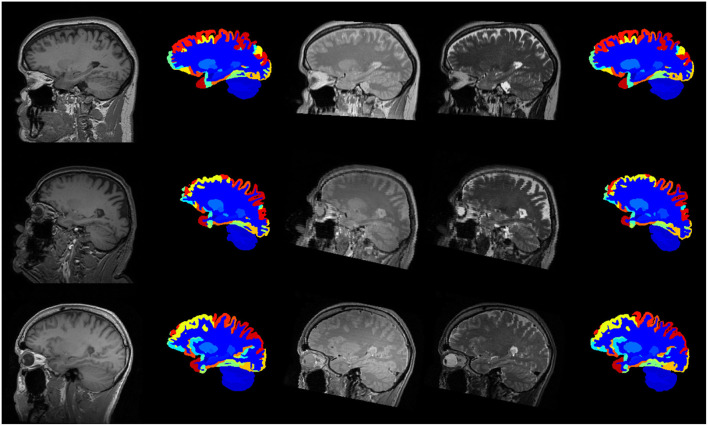 Figure 11