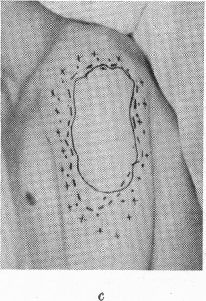 Text-fig. 7c