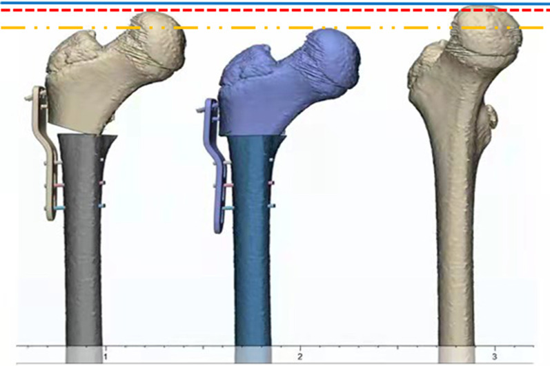 Fig.1