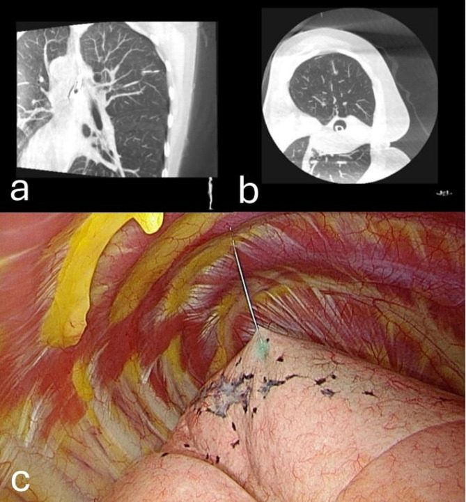 Fig. 6