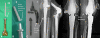 Fig. 5A–E
