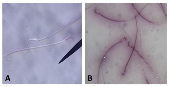 Fig. 1