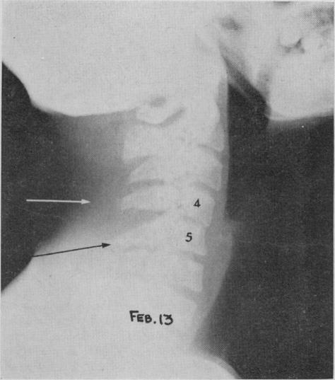 Fig. 12