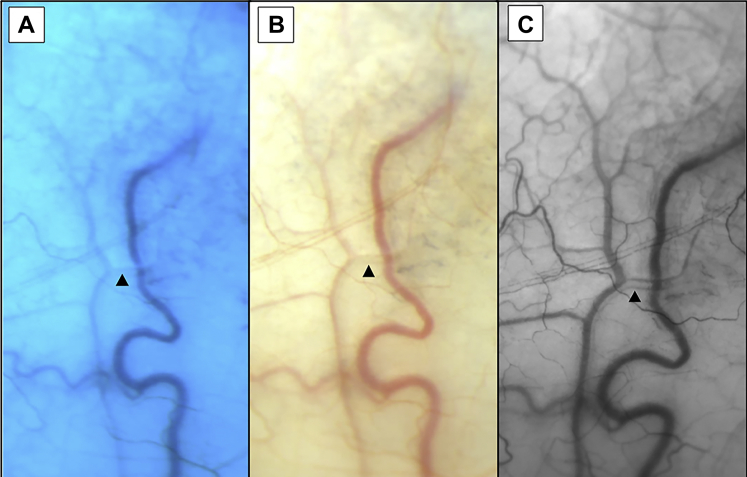 Figure 1