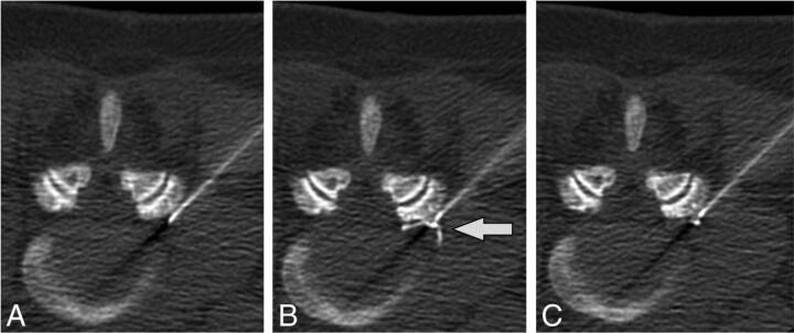 Fig 2.