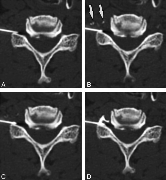 Fig 6.