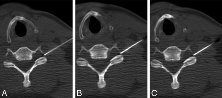 Fig 5.