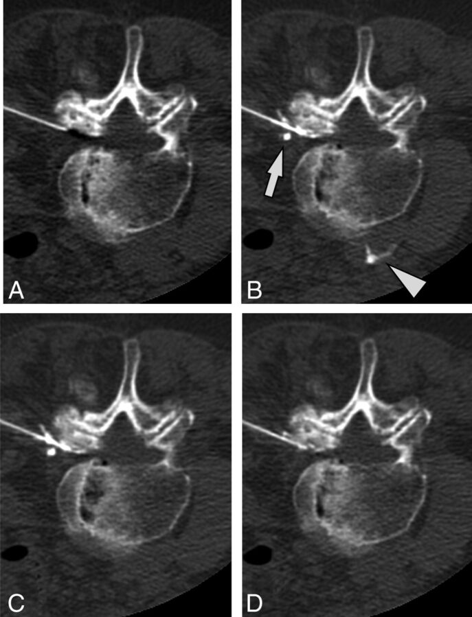 Fig 3.