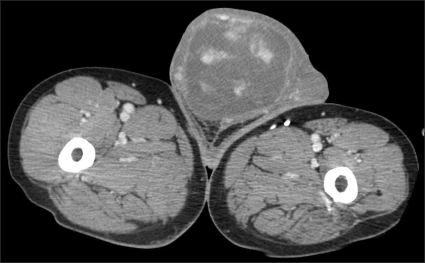 FIG. 1