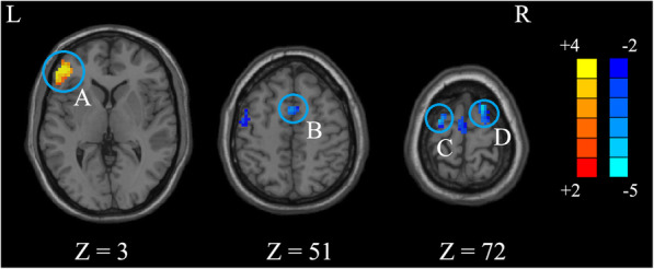 Fig. 2