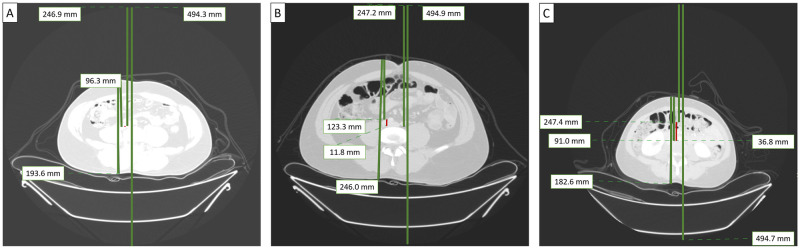 Fig 1