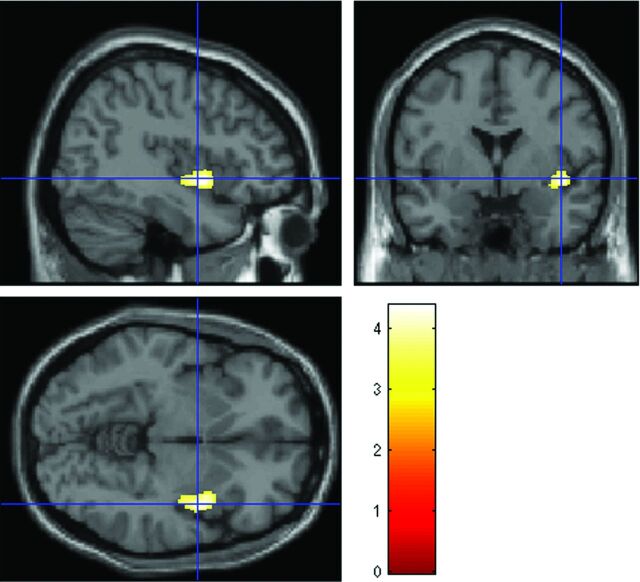 Fig 1.